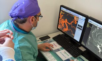 SCJU Cluj, o nouă premieră medicală la nivel regional: intervenții complexe pe vasele creierului, realizate minim invaziv