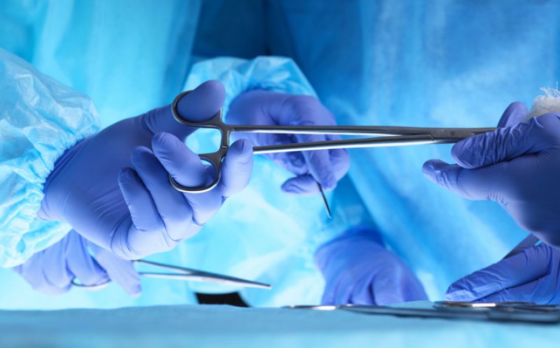 Extirparea apendicelui, asociată cu un risc mai mic de cancer de colon. Ce au descoperit cercetătorii