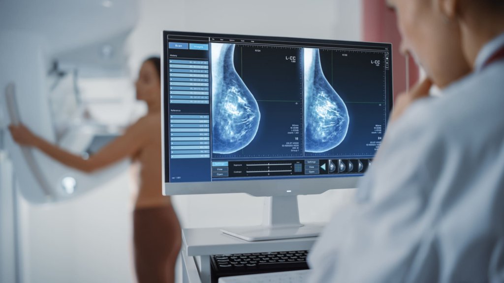 CNAS: Investigațiile pentru suspiciunea de cancer de sân nu depind de plafonul lunar/ Ce servicii pot primi pacientele neasigurate